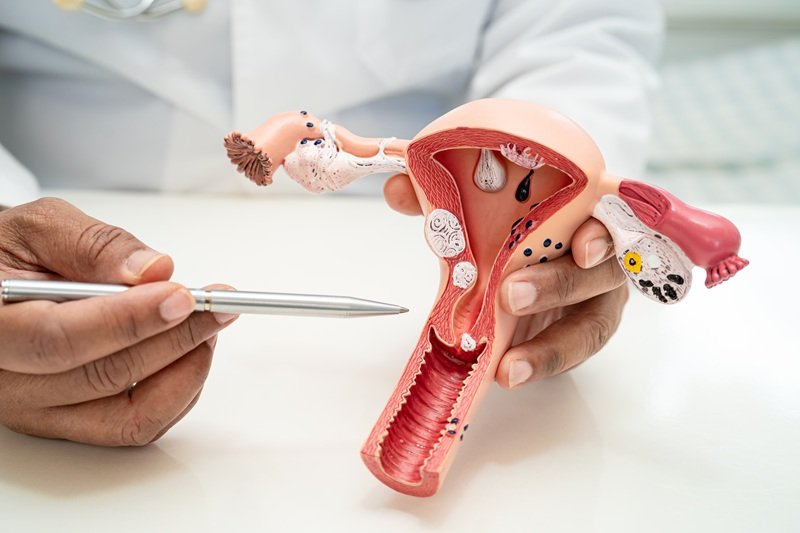 PCR para candidiasis vaginal en Miguel Hidalgo