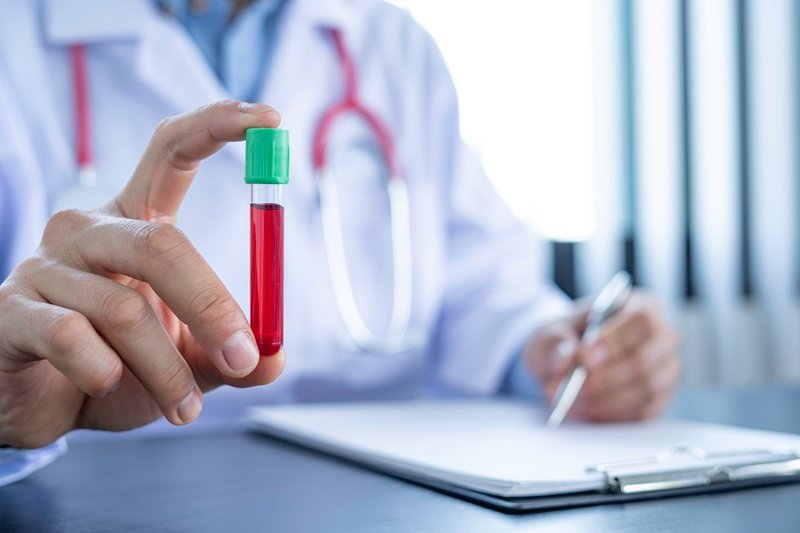 PCR para detección de VPH (28 genotipos) en Miguel Hidalgo